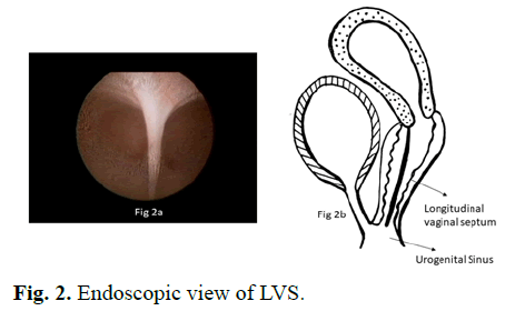 pediatric-Endoscopic pediatric-Endoscopic
