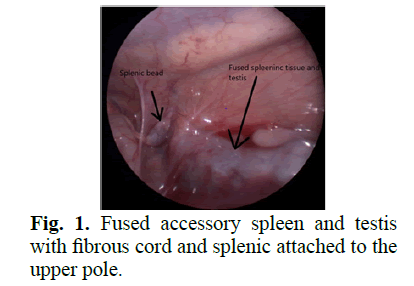 spleen spleen
