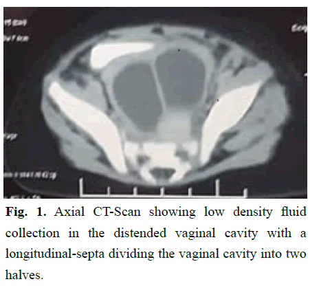 pediatric-vaginal pediatric-vaginal