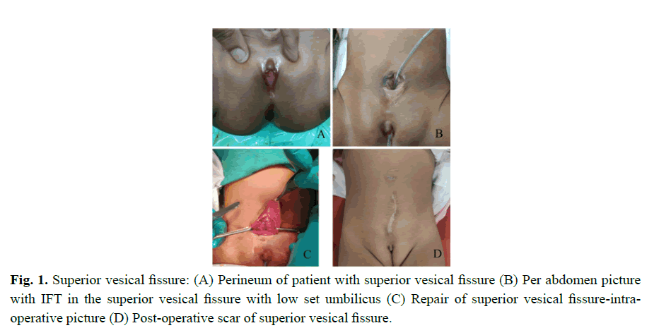 pediatricurology-abdomen-picture pediatricurology-abdomen-picture