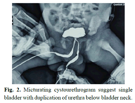 pediatricurology-median-raphes