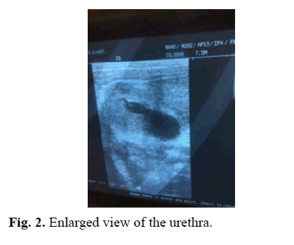 pediatricurology-urethra pediatricurology-urethra