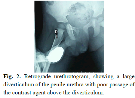 pediatricurology-urethra