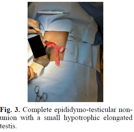 pediatricurology-hypotrophic
