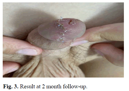 pediatricurology-month pediatricurology-month