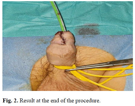 pediatricurology-procedure pediatricurology-procedure