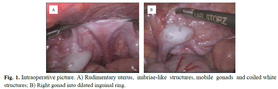 pediatricurology-distal-urethral