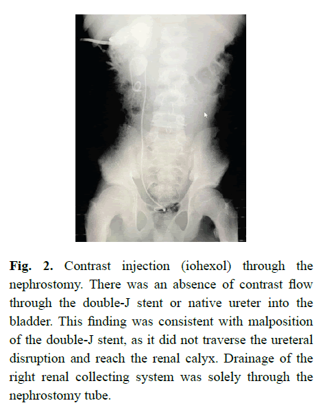 pediatricurology